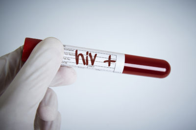 Das Gespräch über eine mögliche HIV-Infektion zählt vermutlich zu den schwierigsten Themen im ärztlichen Bereich. Dabei ist eine HIV-Infektion heute mit nahezu normaler Lebenserwartung und hervorragenden therapeutischen Möglichkeiten zu betrachten. Dabei kommt es vor allem auf eine frühe Diagnose an - eine Checkliste zur HIV-Erstdiagnose hilft.