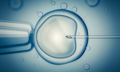 IVF (in vitro fertilization) or insemination of female egg with microscope. Digital illustration.