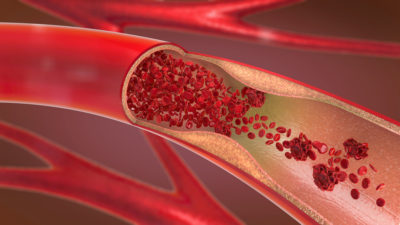 Vene oder Arterie im Querschnitt