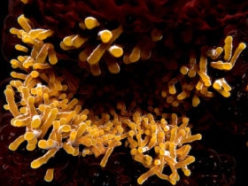 Tuberkuloseviren in der Lunge