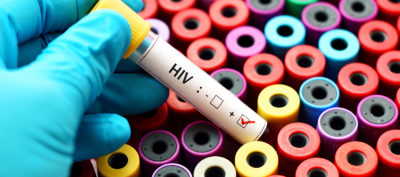 Wie effektiv schützt eine Präexpositionsprophylaxe vor einer HIV-Infektion? Das Robert Koch-Institut hat das nun an einer Kohorte mit über 4000 Nutzern evaluiert. 
