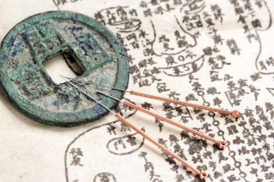 Die Traditionelle Chinesische Medizin ist ab dem 2. Jahrhundert v. Chr. entstanden. Die Ärzte haben die Aufgabe, bei ihren Patienten ein harmonisches Gleichgewicht in Körper und Geist wiederherzustellen. Dazu haben sie unter anderem eine historisch ältere Methode übernommen und perfektioniert: die Akupunktur.