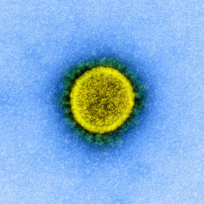 Seit einigen Wochen gibt es Antikörpertests gegen das Corona-Virus (SARS-CoV-2), die Immunität nach durchgemachter Corona-Infektion und damit auch die Durchseuchung der Bevölkerung anzeigen sollen. Was ist von diesen Tests zu halten, soll man sie einsetzen, und wie sind ihre Ergebnisse zu interpretieren?