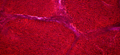 Liver cells under the light microscope. 400 x magnification. - Leberzellen unter dem Lichtmikroskop. Vergrösserung 400x.