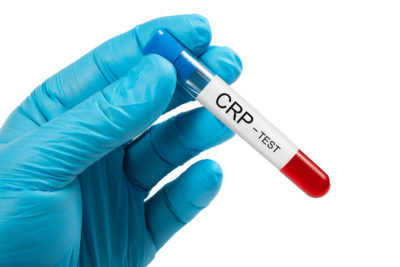 Virale und bakterielle Atemwegsinfektionen lassen sich anhand der typischen Symptome gut voneinander unterscheiden. Im Zweifelsfall kann der CRP-Test helfen, die Diagnose zu finden und zu entscheiden, ob ein Antibiotikum nötig oder überflüssig ist.