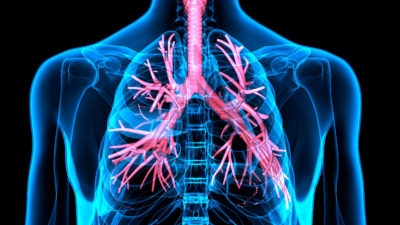 lunge, asthma, 3d