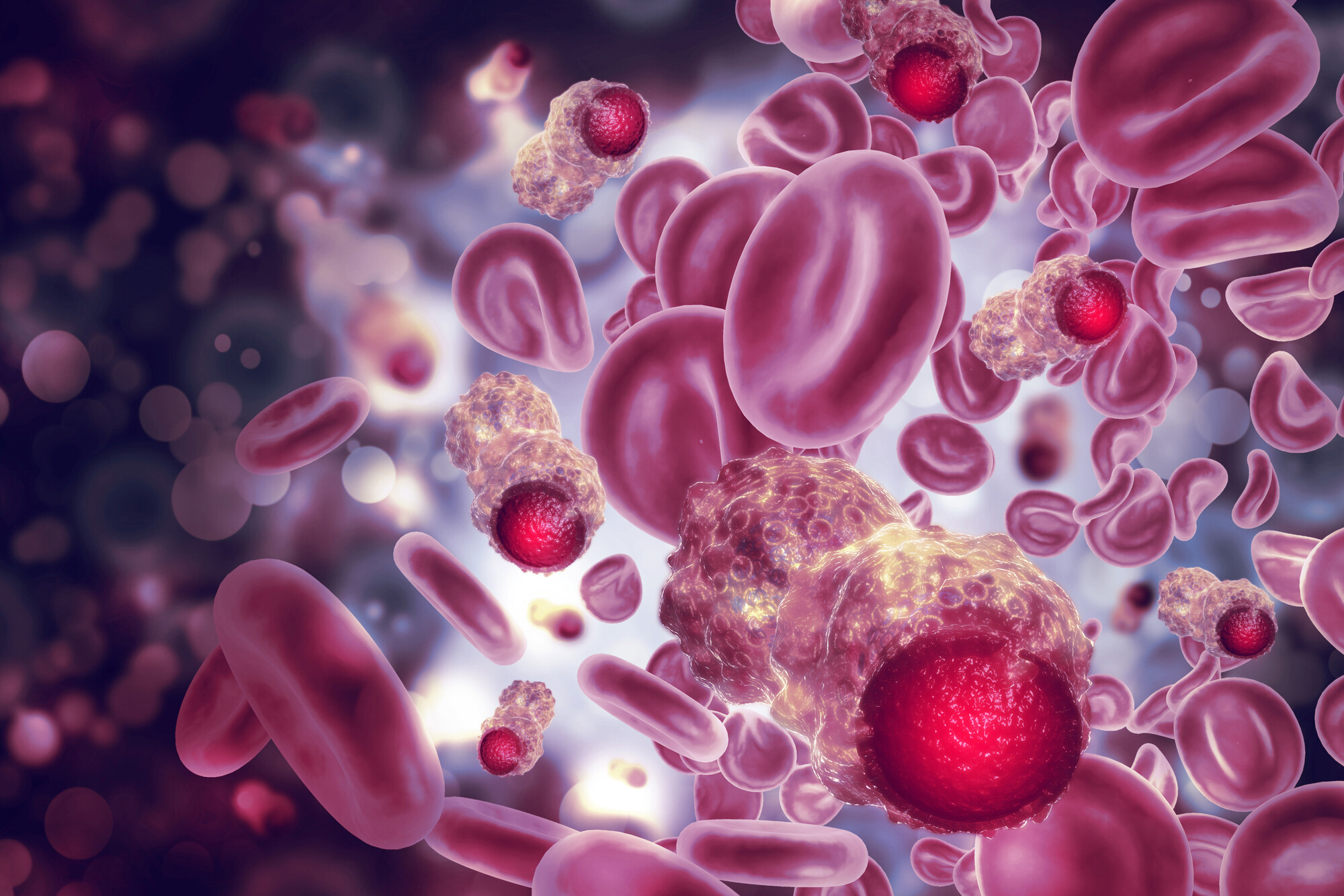 3D-Illustration von Blutkrebszellen